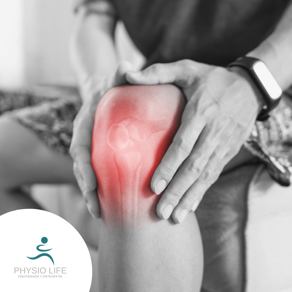 Rehabilitación de rodilla con fisioterapia en Mérida Yucatán