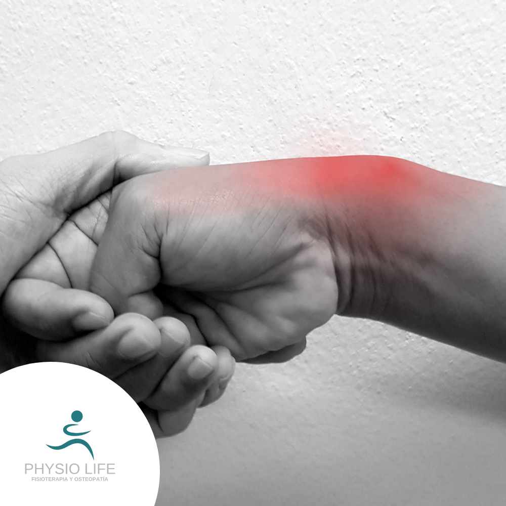 Lesiones Deportivas Más Comunes y Cómo Prevenirlas